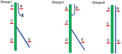 Experimental study on the repair of peripheral nerve injuries via simultaneously coapting the proximal and distal ends of peripheral nerves to the side of nearby intact nerves